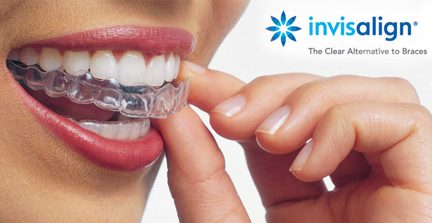 Orthodontic Vancouver WA
