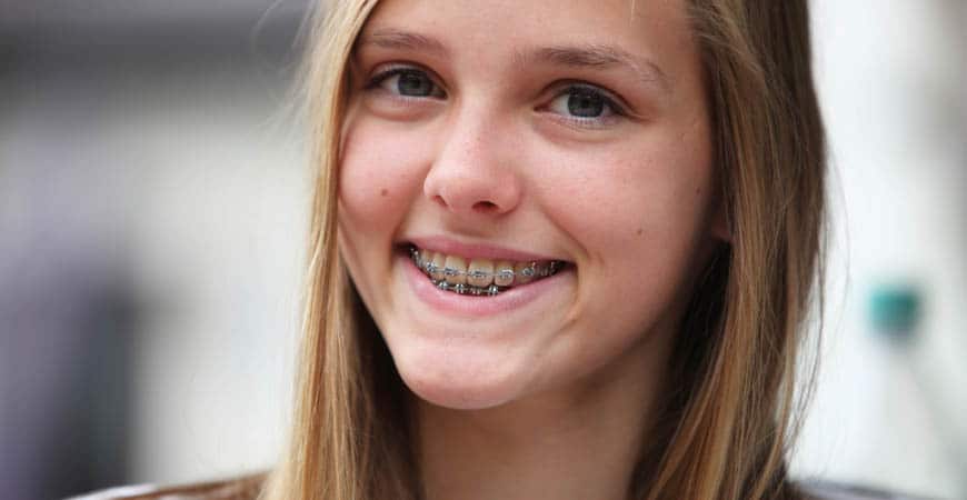 Time for Braces in Vancouver WA?