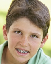 Orthodontics Vancouver- Tips to Relieve Pain From Braces