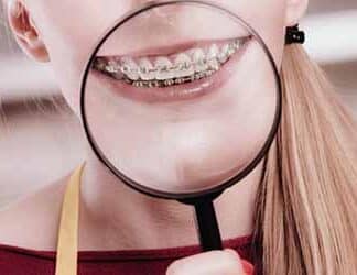 Rubber Band Wear - Orthodontist Vancouver WA