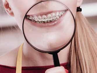 Braces vs. Invisalign: What Should I Get?